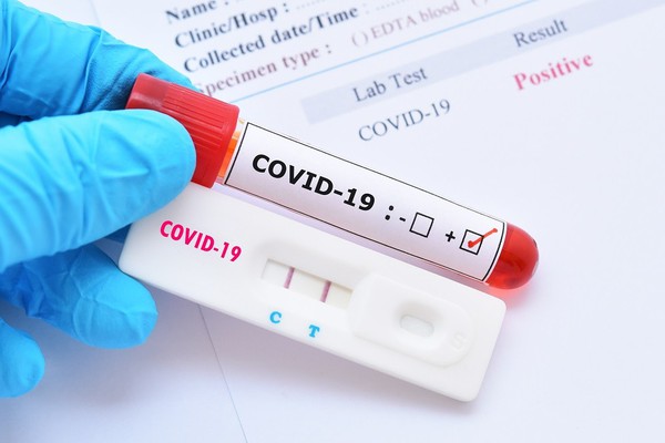 Boletim extraordinário confirma mais uma morte por Covid-19 e mais 383 casos da doença
