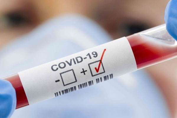 Patos de Minas tem novos 53 casos de Covid-19, e pacientes voltam a ser internados em UTIs