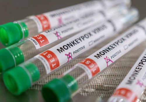 Anvisa autoriza dispensa de registro de vacinas para varíola dos macacos